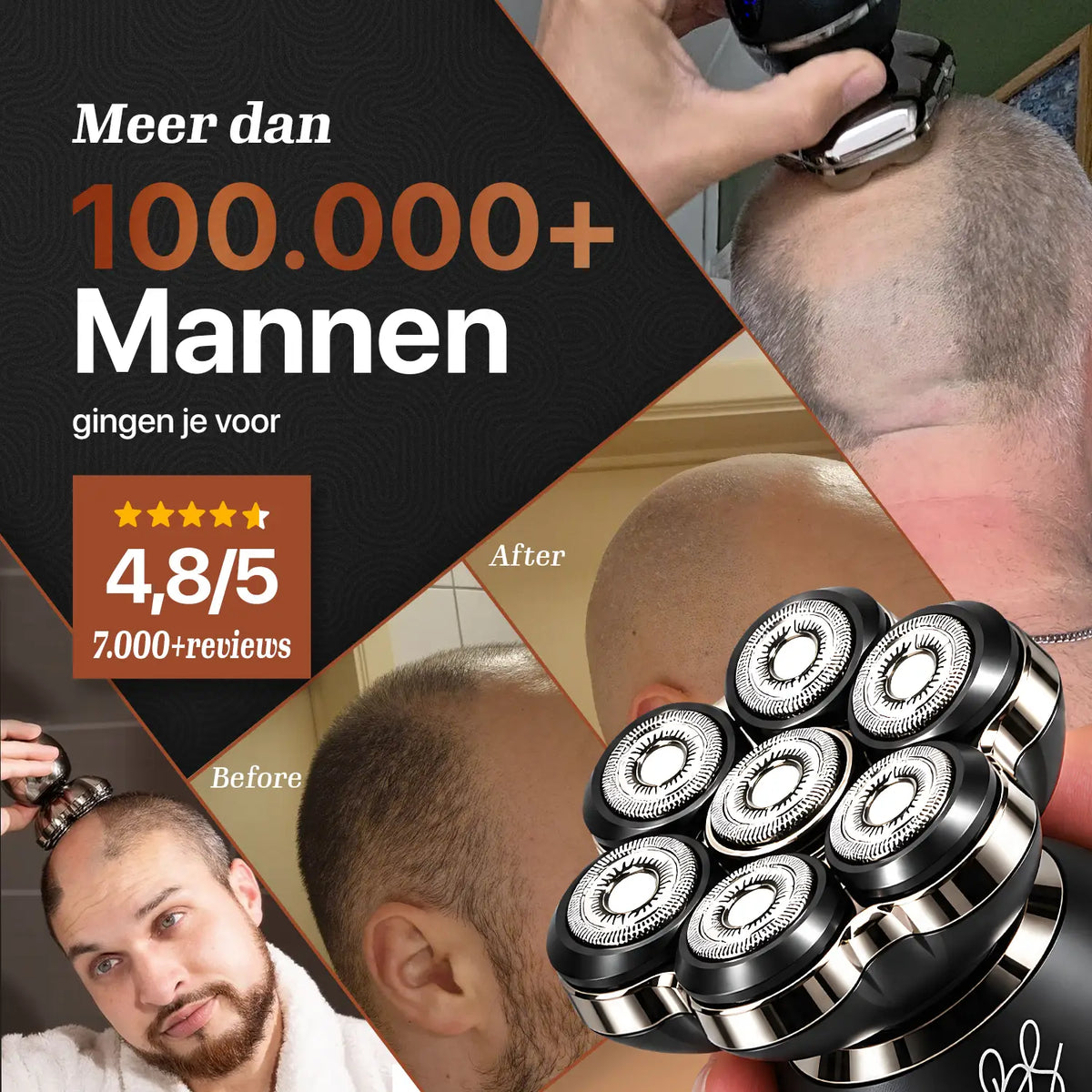 Skull Master Pro in gebruik met voor-en-na resultaat op het hoofd.