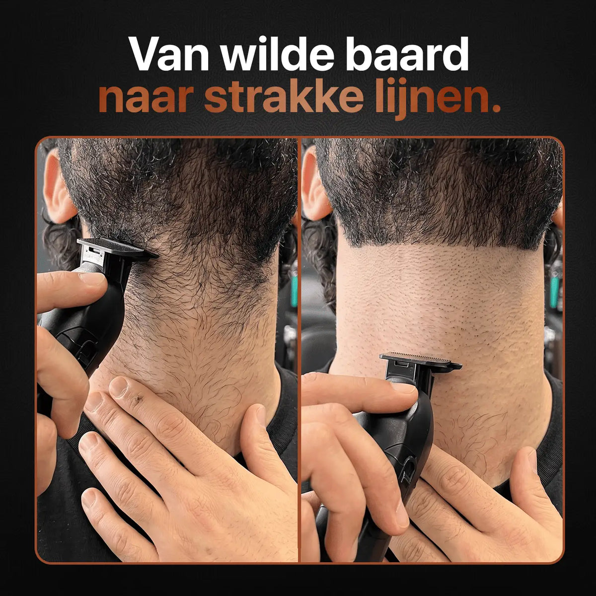Beard trimmer creates a clean neckline with a visible before-and-after result